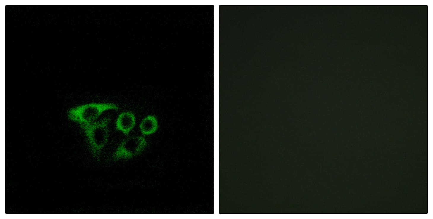 ATP5L2 Antibody (aa51-100)