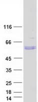 Human TSAP6 / STEAP3 Protein (Recombinant Myc-DDK (Flag))