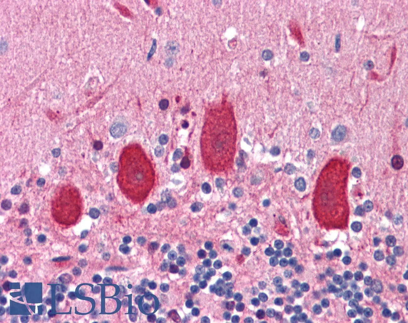 IHC-plus™ APCL / APC2 Antibody