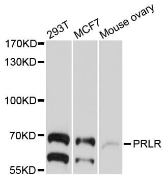 Polyclonal Rabbit anti-Human PRLR / Prolactin Receptor Antibody (WB)