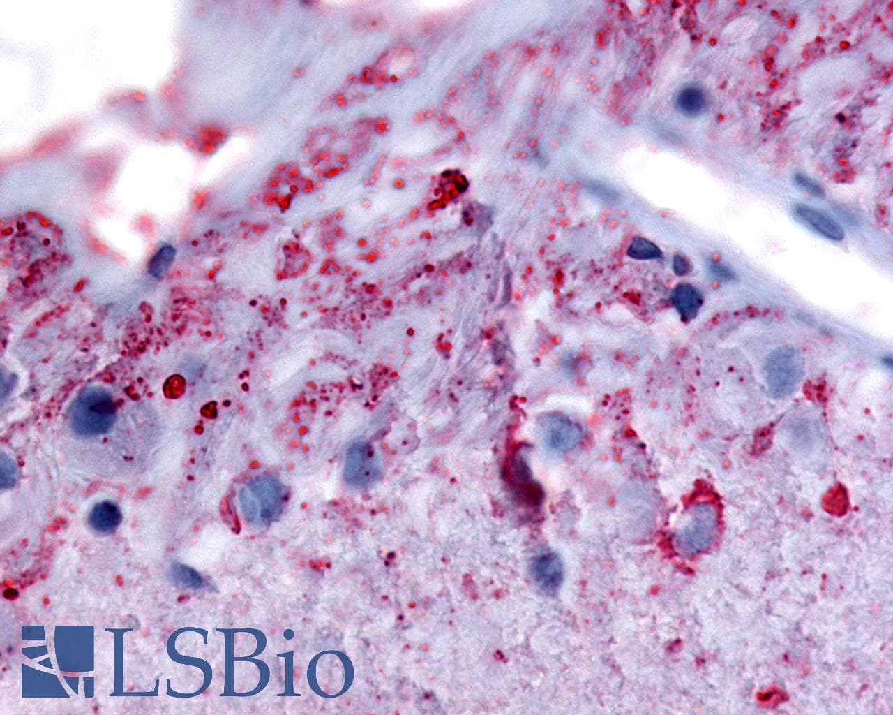 PathPlus™ GRM6 / MGLUR6 Antibody (N-Terminus)