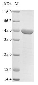 Mouse DHODH Protein (Recombinant 6His, N-terminus)