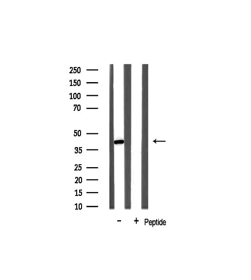 NPM1 / NPM / Nucleophosmin Antibody
