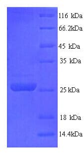 Pig Trypsin Protein (Recombinant His)