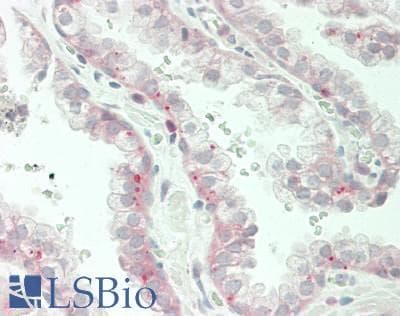 IHC-plus™ Polyclonal Rabbit anti-Human TRPV4 Antibody (Internal, IHC, WB)
