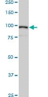 IHC-plus™ Monoclonal Mouse anti-Human ACTN4 Antibody (clone 4D10, IHC, IF, WB)