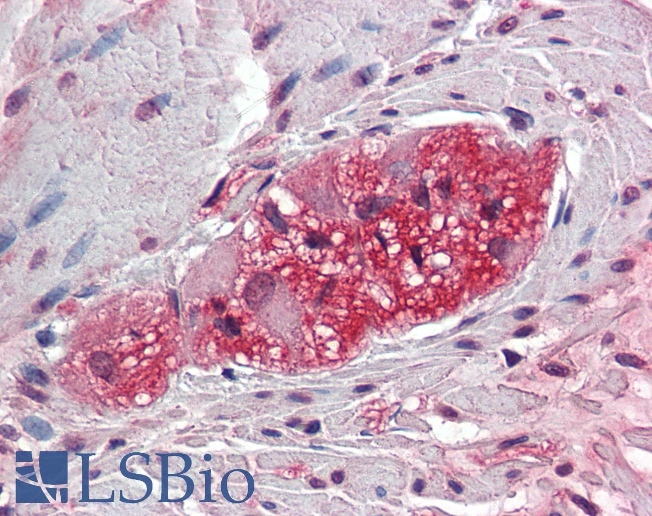 IHC-plus™ Polyclonal Rabbit anti-Human TXLNB Antibody (Internal, IHC)