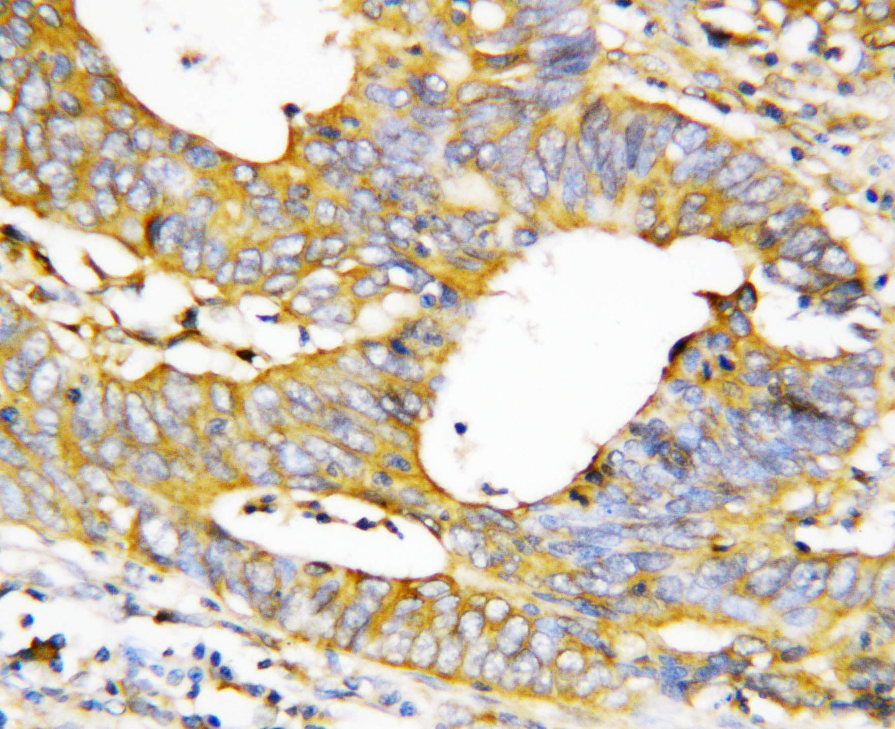 CASP1 / Caspase 1 Antibody (aa135-152)