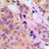 MAP3K8 / TPL2 Antibody (phospho-Thr290)