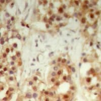 NXF3 Antibody (Internal)