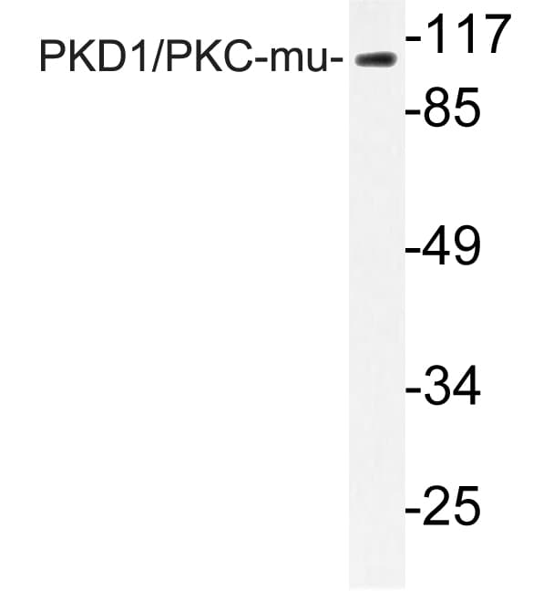 PRKD1 / PKC Mu Antibody (aa695-744)