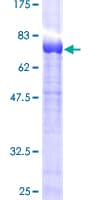 Human SNX8 Protein (Recombinant GST)