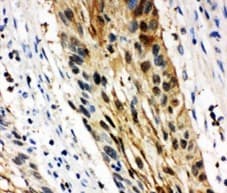 SFN / Stratifin / 14-3-3 Sigma Antibody (aa140-156)