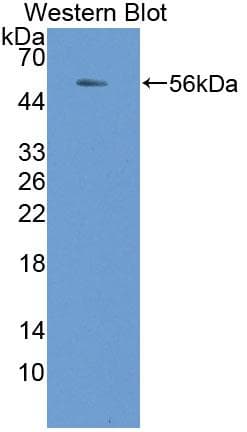 NADK / NAD Kinase Antibody (aa187-426)