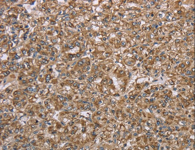 LASS4 Antibody