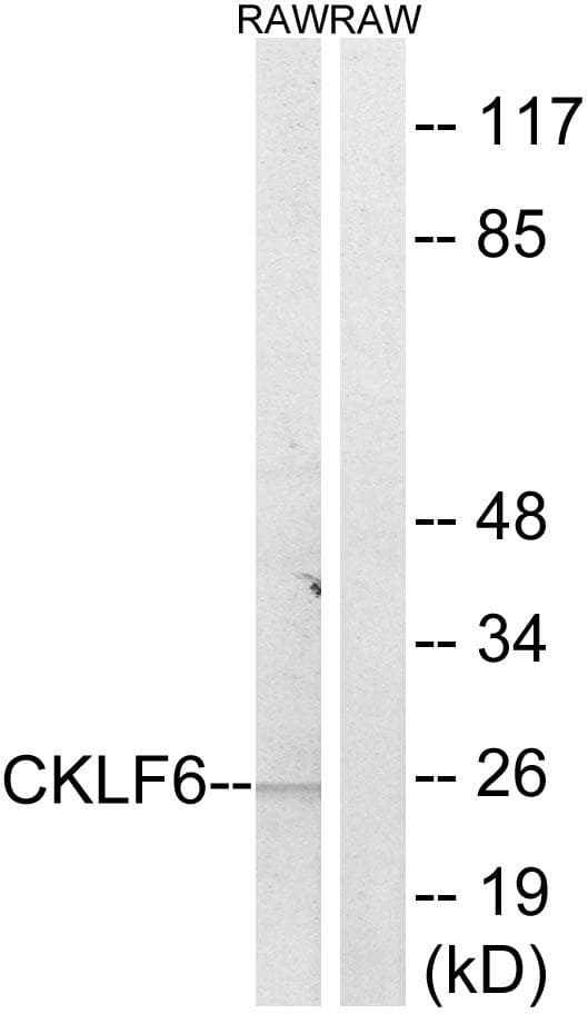 Polyclonal Rabbit anti-Human CMTM6 / CKLFSF6 Antibody (WB)