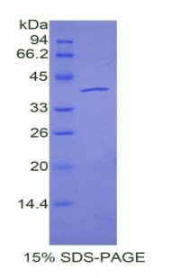 Mouse ANGPT4 / Angiopoietin-4 Protein (Recombinant His-GST)