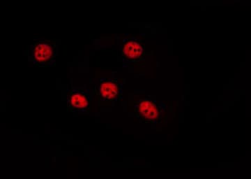 GTF3A Antibody