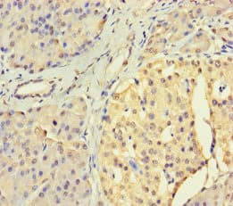 USP3 / UBP Antibody