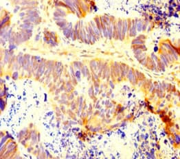 INTS9 Antibody
