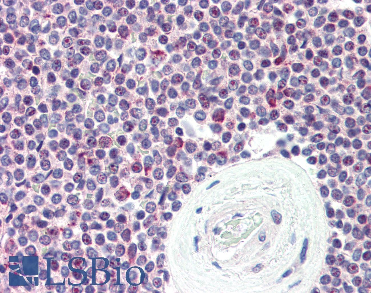 IHC-plus™ SYNGR2 / Synaptogyrin 2 Antibody (Internal)