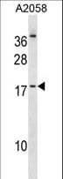 NHLH2 / HEN2 Antibody (aa63-91)