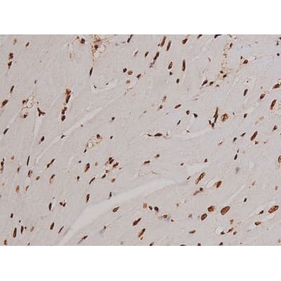 FAK / Focal Adhesion Kinase Antibody (phospho-Tyr397)