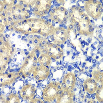 IHC-plus™ ABAT Antibody