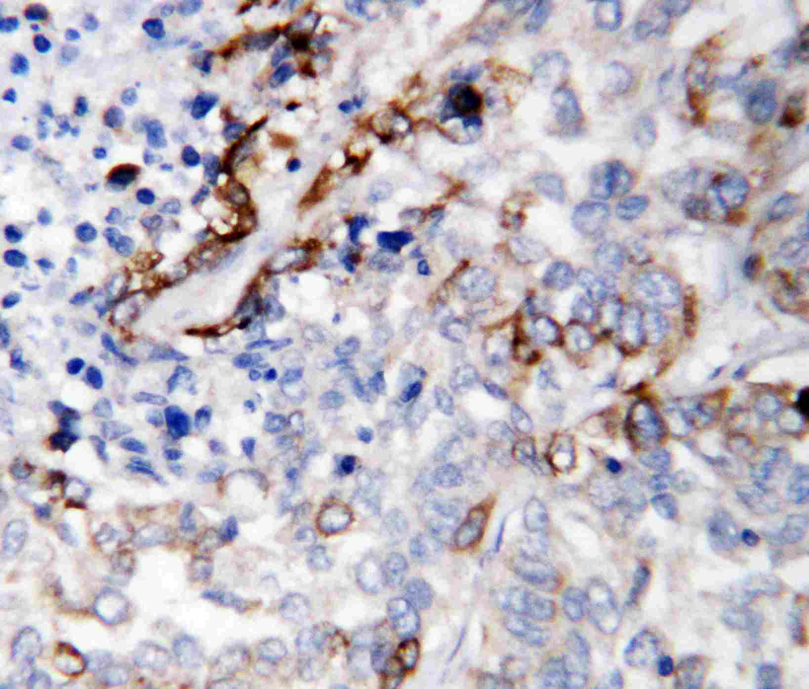 Polyclonal Rabbit anti-Human LAMC2 / Laminin Gamma 2 Antibody (aa1160-1180, IHC, WB)