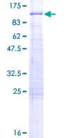 Human ALDH16A1 Protein (Recombinant GST)