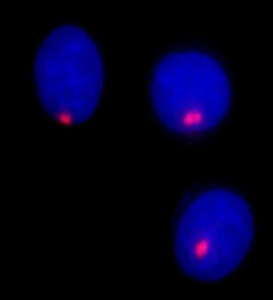 PCNT / Pericentrin Antibody (aa175-225)