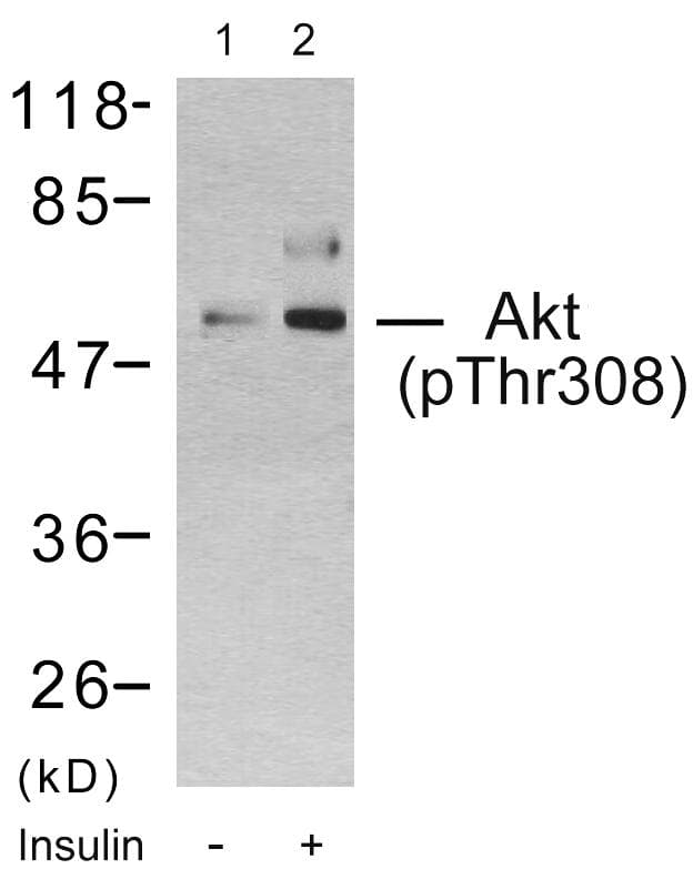 AKT1 Antibody (phospho-Thr308)