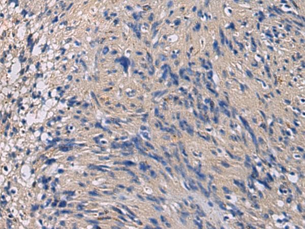 CHST3 Antibody