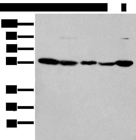 Polyclonal Rabbit anti-Human PFK2 / PFKFB3 Antibody (WB)