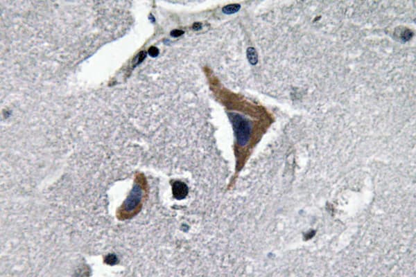 Neurophysin Antibody (Lys40)
