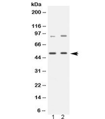 Polyclonal Rabbit anti-Human MAP3K8 / TPL2 Antibody (IHC, WB)