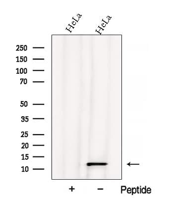 ATPIF1 / ATPI Antibody
