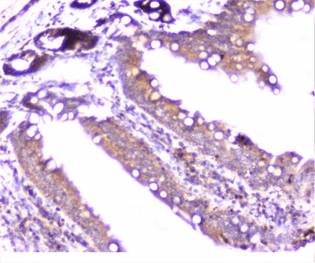 Polyclonal Rabbit anti-Human CTTN / Cortactin Antibody (IHC, IF, WB)
