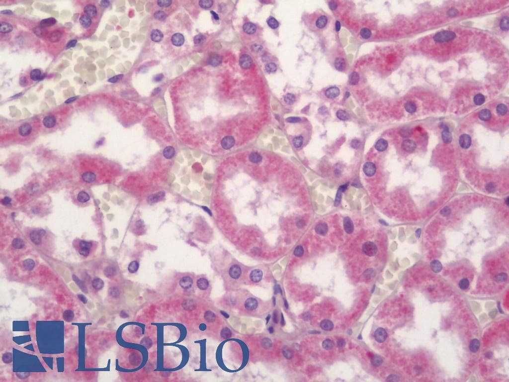 IHC-plus™ CEP44 / KIAA1712 Antibody (aa278-307)