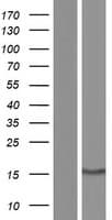 SCP2 / SCPX Protein (Over-Expression Lysate Myc-DDK (Flag))
