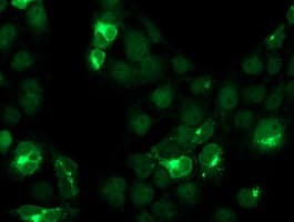 CST4 / Cystatin S Antibody (clone OTI2H10)