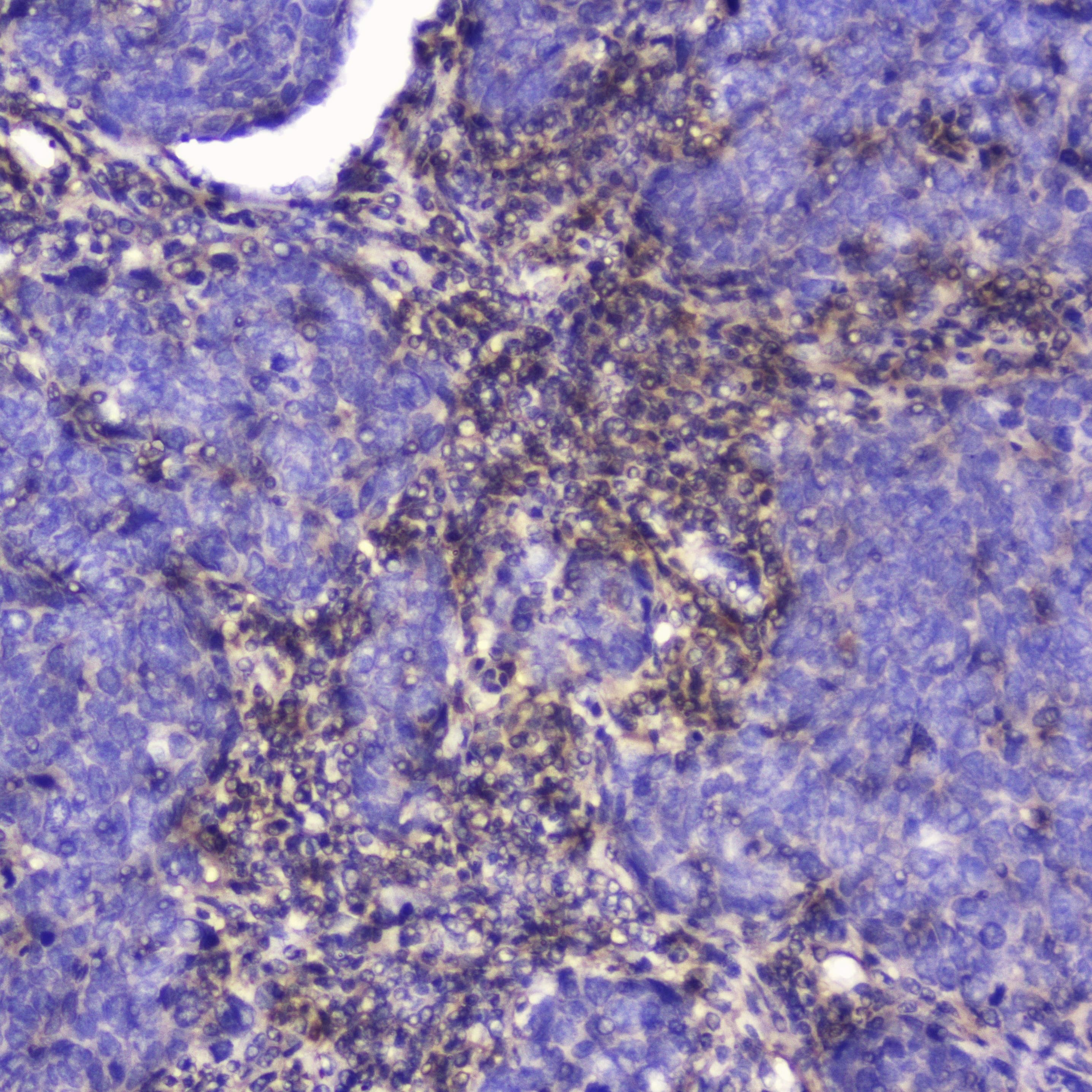 TLN1 / Talin 1 Antibody