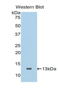SFRP4 Antibody (aa265-346)