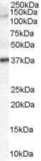 IHC-plus™ GALR3 / Galanin Receptor 3 Antibody (aa349-362)