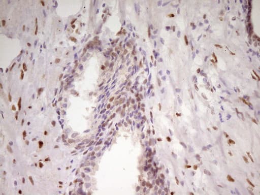 MEF2D Antibody (aa1-282, clone OTI10B4)