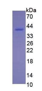 Human RETN / Resistin Protein (Recombinant)