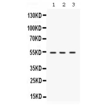SPTLC1 / HSN1 Antibody (aa444-473)