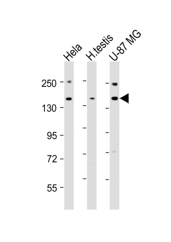 USP47 Antibody (aa588-620)