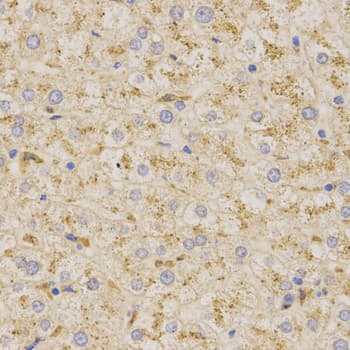 Polyclonal Rabbit anti-Human PSAP / Prosaposin Antibody (IHC, IF, WB)