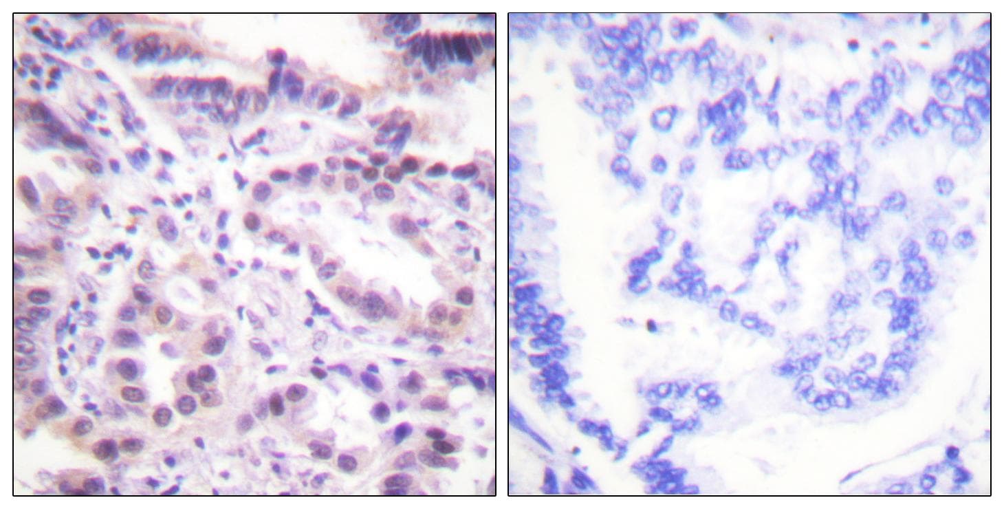 ERF / PE2 Antibody (phospho-Thr526)